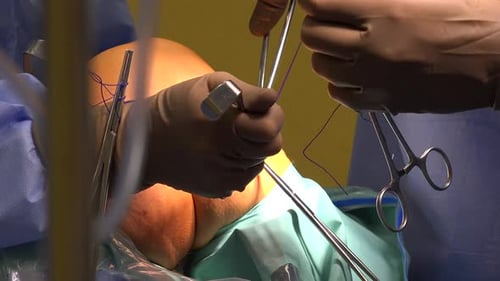 Surgeons Performing Knee Surgery Using Instruments and Sutures