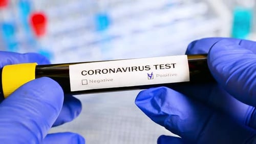 Coronavirus Test Labeled Positive Being Held By Gloved Hand