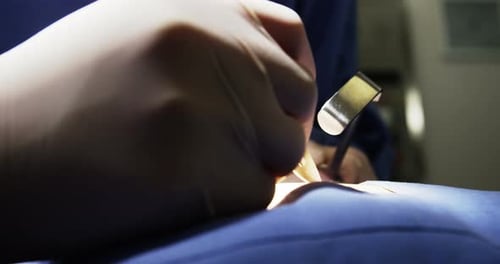 Close-up of surgeons performing operation in operation room