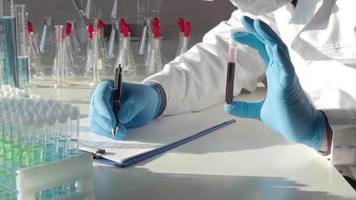 Scientist Analyzing Blood Sample in Medical Lab