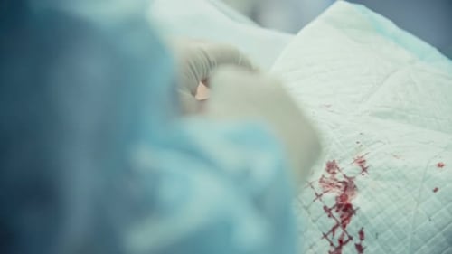 Coronary Bypass Surgery