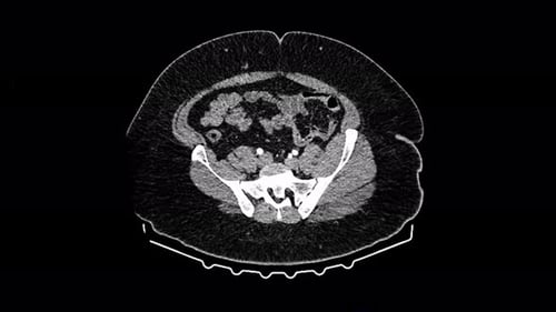 Magnetic Resonance Radiologist Visualization MRI Scan on Screen Computer