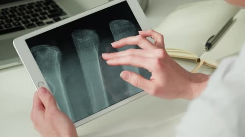 Hands Using Tablet Showing Bone X-Ray