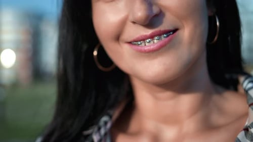 Smiling Female Mouth with Teeth in Braces Brunette Woman Posing Summer Sunset Outdoor City Street