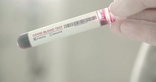 Gloved Hand Holds Positive COVID Blood Test