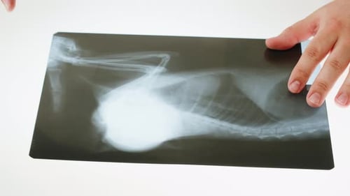 Person Examines X-Ray on Light Table