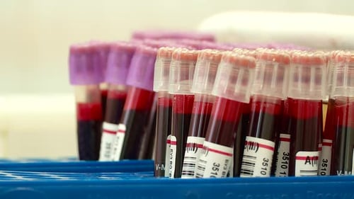 Tubos de ensayo. Estación de transfusión de sangre. Donante de sangre. Operación. En el hospital. Un corazón.