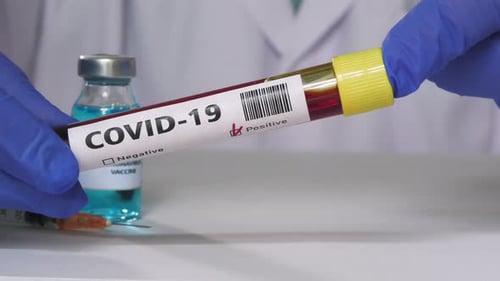 Analysis of blood of the coronavirus in hospital laboratory was positive for Covid-19