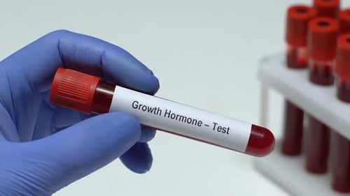 Growth Hormone-Test, Doctor Holding Blood Sample in Tube Close-Up, Health