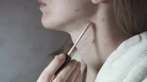Woman Applying Concealer to Acne Blemishes on Neck