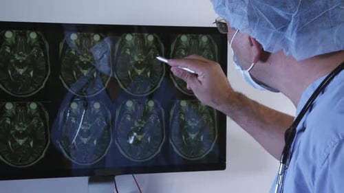 Doctor Examining Brain Scan in Hospital