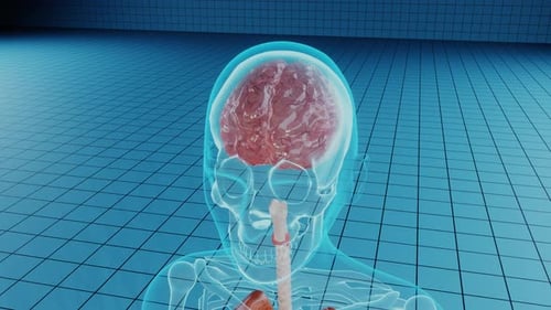 Brain Damage in Human Body