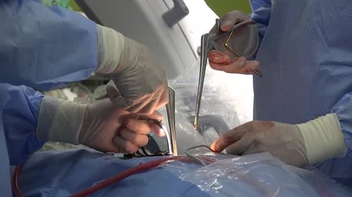 chirurgie du rachis