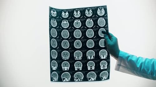 CT Scan Analysis by Doctor
