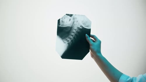 Hand Holding an X-ray of a Neck and Skull