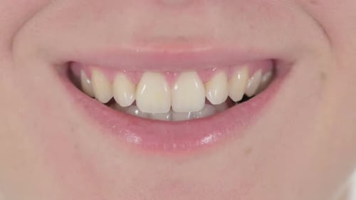 Close Up of Smiling Lips of Woman