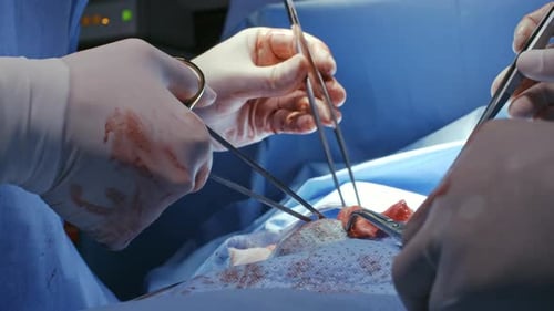 Surgeons Performing Operation with Medical Instruments