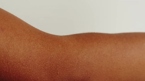 Close Up of Person's Arm Skin Details