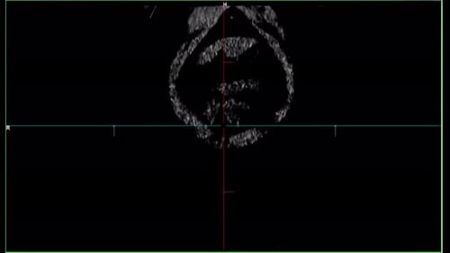 Medical Scan of Human Torso CAT Scan