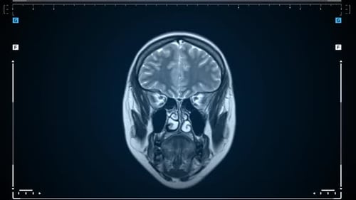 Human Head MRI Scan Medical Imaging Animation Loop