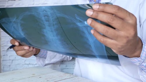 Doctor Reviewing X-Ray in Hospital Setting