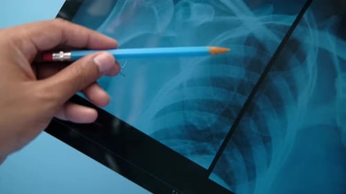 Doctor Hold Analyzing Xray Photography, Closeup