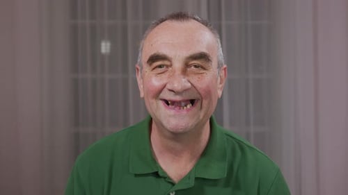 The Man Teeth Fell Out, Yellow and Black Teeth Hurt. Poor Teeth Condition, Erosion, Caries