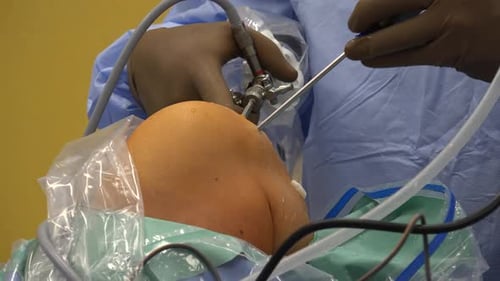 Surgeon Performing Minimally Invasive Knee Surgery