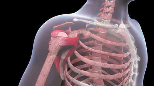 Shoulder Injury With Small Crescent Tear Of The Rotator Cuff