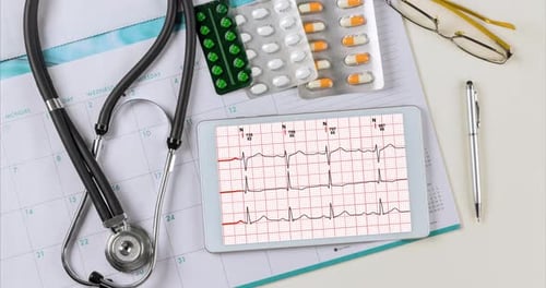 Medizinischer Arbeitstisch Doctor Desk mit Herzkardiogramm der Welle auf Kardiographie Herzberichtsanalyse
