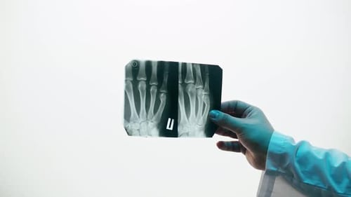 Hand Fingers Xray Closeup