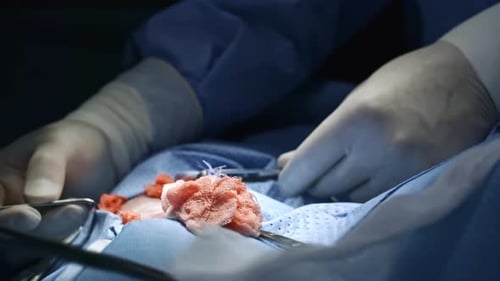 Chirurgen nähen Patienten an den Händen