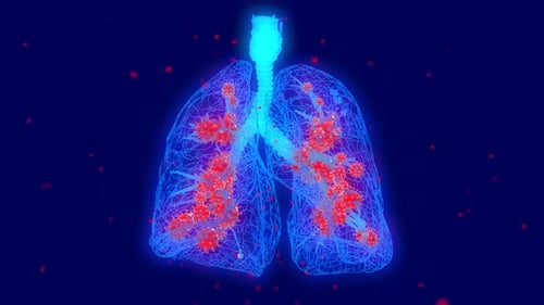 Digital Wireframe Lungs with Spreading Virus Infection Animation