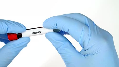 Scientist Holding Virus Blood Sample Vial