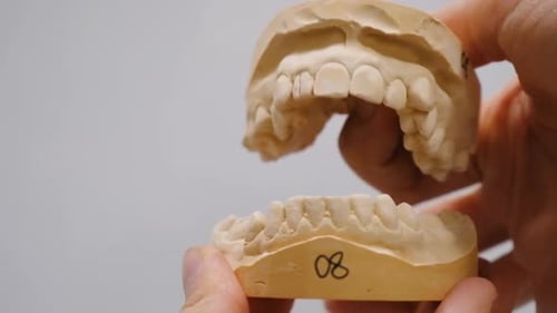 Dental Mold of Teeth Close Up