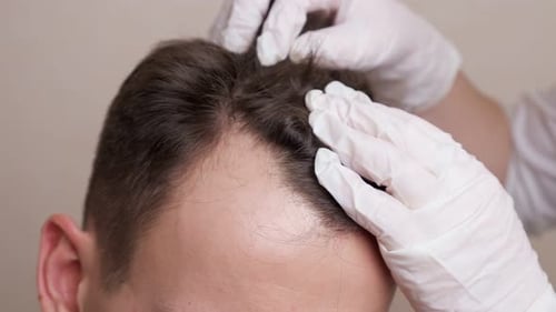 Medical Exam of Hair and Scalp