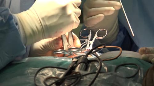 Surgical Procedure with Instruments in Operating Room