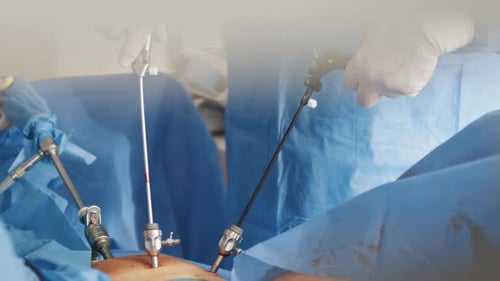 Surgical Instruments Used During Laparoscopic Procedure
