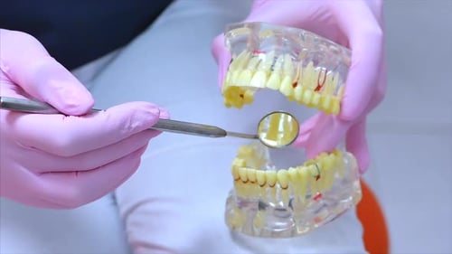 Woman Dentist Treating Teeth To Woman Patient in Clinic.Dentist Shows the Patient on the Model of