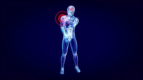 3D Human Anatomy Scan with Shoulder Pain Indicator