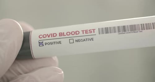 Covid Blood Test Marked Positive, Macro Shot