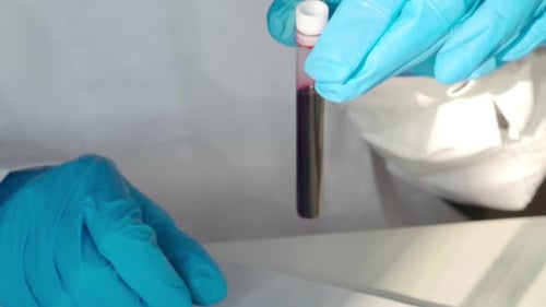 Close Up Photo of Blood Sample in Researcher's Hands.