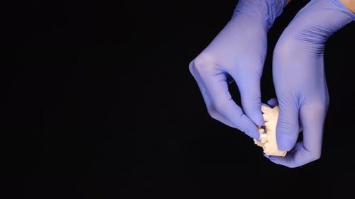 Dental Mold Held by Gloved Hands on Black