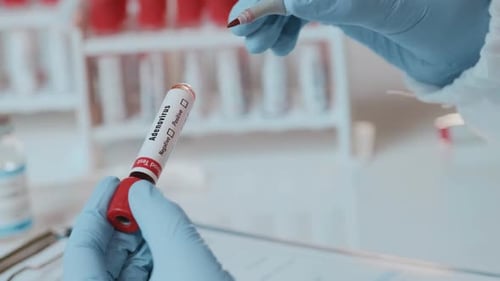 Blood Test Marked Positive for Adenovirus in Lab