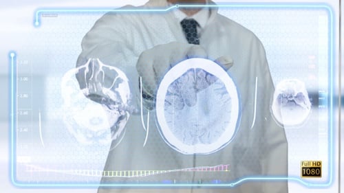 Arzt untersucht Hi-Tech-Gehirn-MRT-Scan