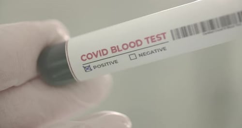 Positiver Blutvirustest