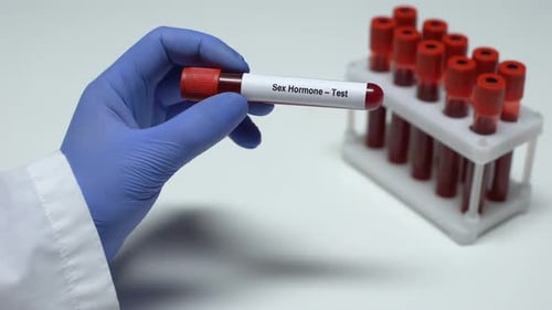 Sex Hormone, Doctor Showing Blood Sample in Tube, Lab Research, Health Checkup