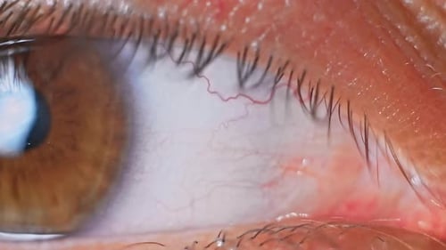 Extreme Close Up of Brown Eye Opening