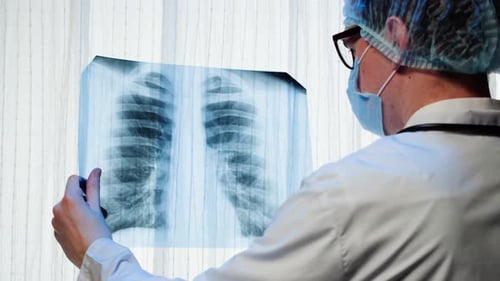 Medical Professional Inspecting an X-Ray in a Hospital