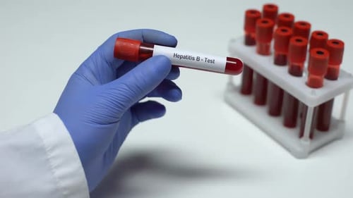 Blood Test for Hepatitis B in Laboratory